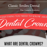 Everything You Need to Know about Dental Crowns