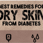 Best Remedies  for Diabetes Dry Skin