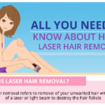 All You Need To Know About Home Laser Hair Removal