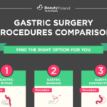 Gastric surgery procedures comparison